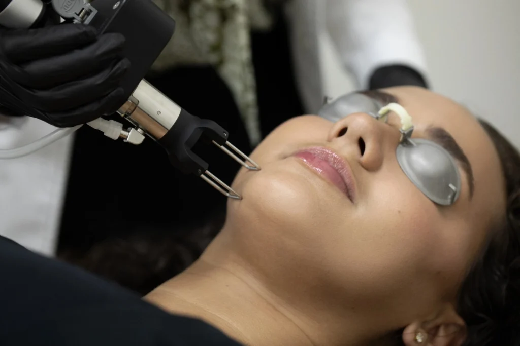 R&R Skin and Aesthetics CO₂ Laser Treatments in Pinecrest, FL