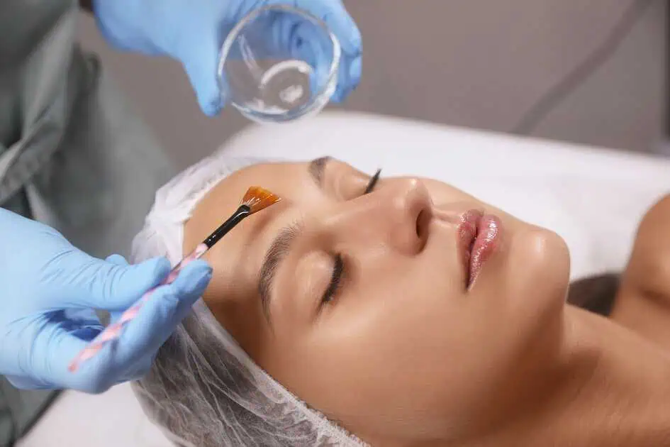 Chemical Peels in Pinecrest, FL by R&R Skin and Aesthetics